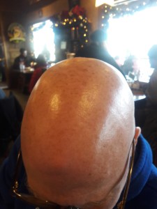 my father's head, everyone.